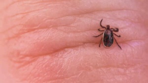 Fitness Influencer's Paralysis Highlights Rising Threat of Tick-Borne Illnesses