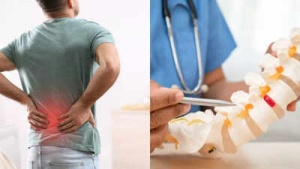 Is It Back Pain or a Slipped Disc? Key Differences to Know