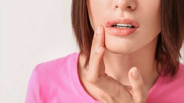 Recognizing non-healing sores as possible skin cancer symptom