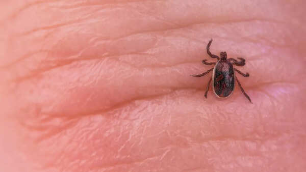 Close-up of a tick, a carrier of babesiosis